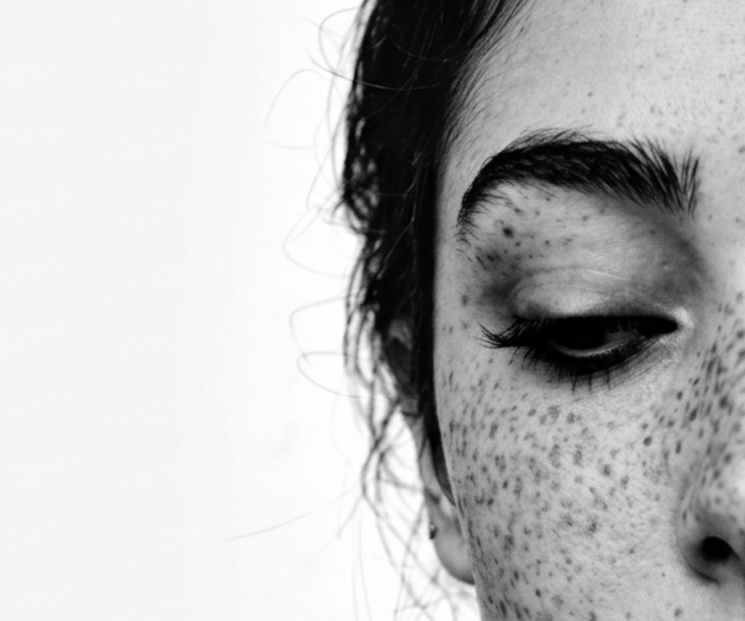 Half of a freckled face with eyes lowered, on a white ground.